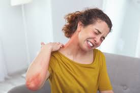 Anaphylactic Shock: Symptoms, Causes, Treatment